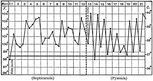 Fig. 12.—Chart of case of Septicæmia followed by Pyæmia.
